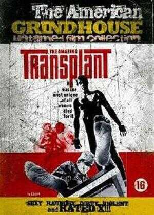 惊人的移植海报